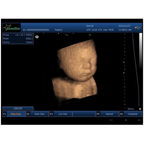 Portable Veterinary Light Weight Ultrasound 7.5MHz Linear Probe  LX-BW-L3 B ULTRASOUND