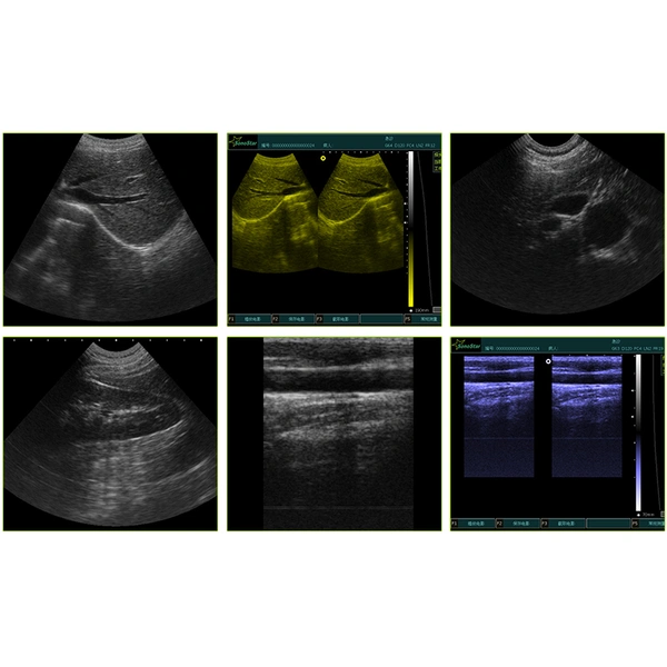 Portable Veterinary Light Weight Ultrasound 7.5MHz Linear Probe  LX-BW-L3 B ULTRASOUND