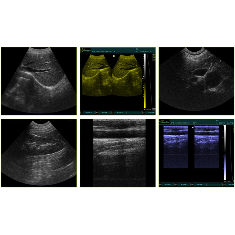 Portable Veterinary Light Weight Ultrasound 7.5MHz Linear Probe  LX-BW-L3 B ULTRASOUND