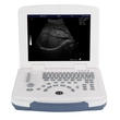 2D Ultrasound Machine/Cheap Laptop Portable Ultrasound LX-BW-L4 B ULTRASOUND