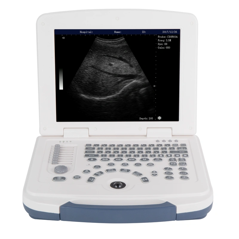2D Ultrasound Machine/Cheap Laptop Portable Ultrasound LX-BW-L4 B ULTRASOUND