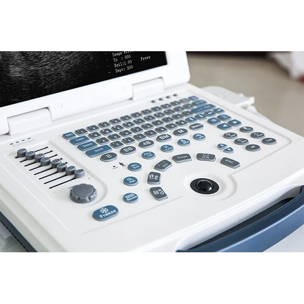 2D Ultrasound Machine/Cheap Laptop Portable Ultrasound LX-BW-L4 B ULTRASOUND