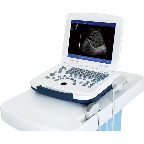 2D Ultrasound Machine/Cheap Laptop Portable Ultrasound LX-BW-L4 B ULTRASOUND