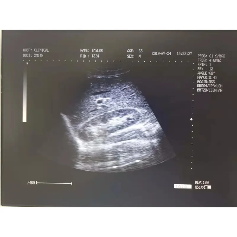 2D Ultrasound Machine/Cheap Laptop Portable Ultrasound LX-BW-L4 B ULTRASOUND