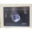 2D Ultrasound Machine/Cheap Laptop Portable Ultrasound LX-BW-L4 B ULTRASOUND