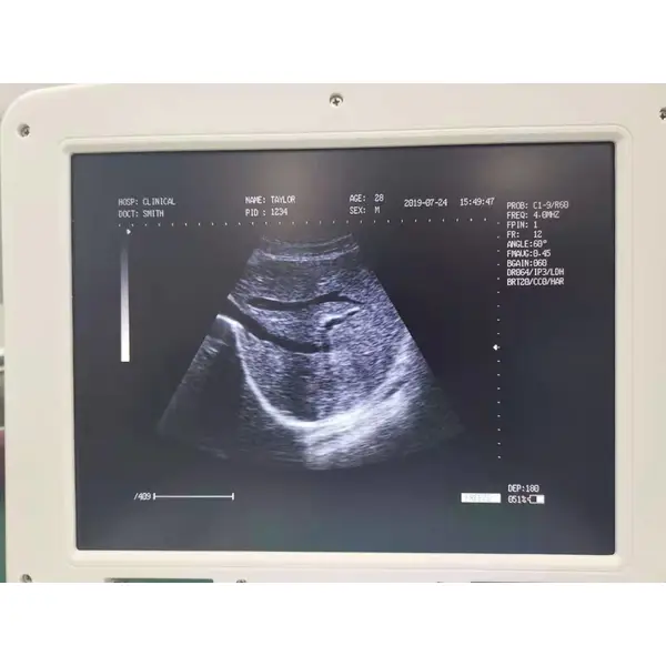 2D Ultrasound Machine/Cheap Laptop Portable Ultrasound LX-BW-L4 B ULTRASOUND