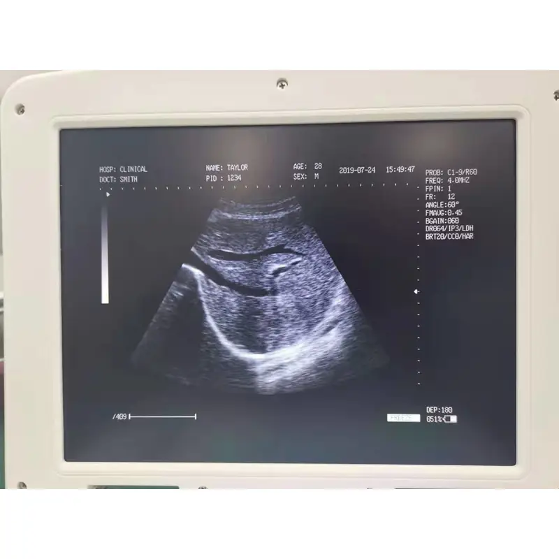2D Ultrasound Machine/Cheap Laptop Portable Ultrasound LX-BW-L4 B ULTRASOUND