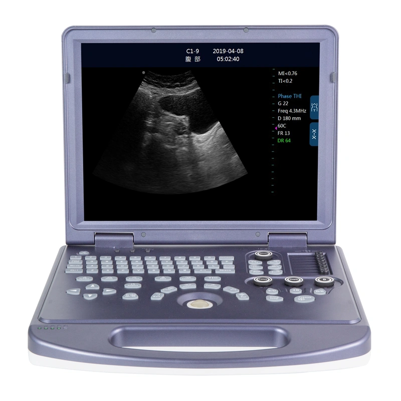 LX-BW-L5 B ULTRASOUND