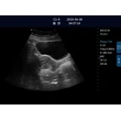 LX-BW-L5 B ULTRASOUND