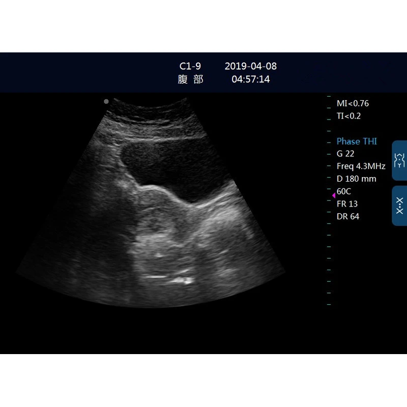 LX-BW-L5 B ULTRASOUND