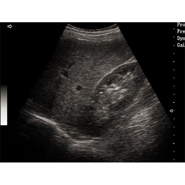 LX-BW-T5 B ULTRASOUND