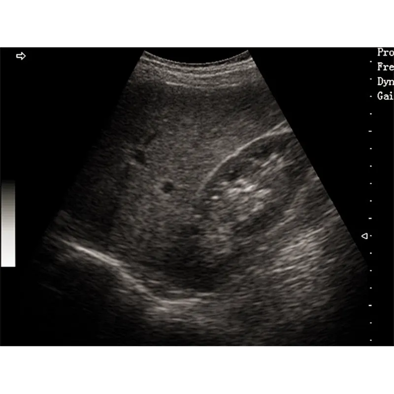 LX-BW-T5 B ULTRASOUND