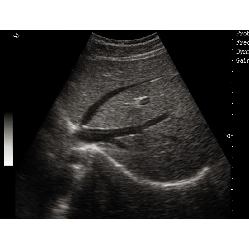 LX-BW-T5 B ULTRASOUND