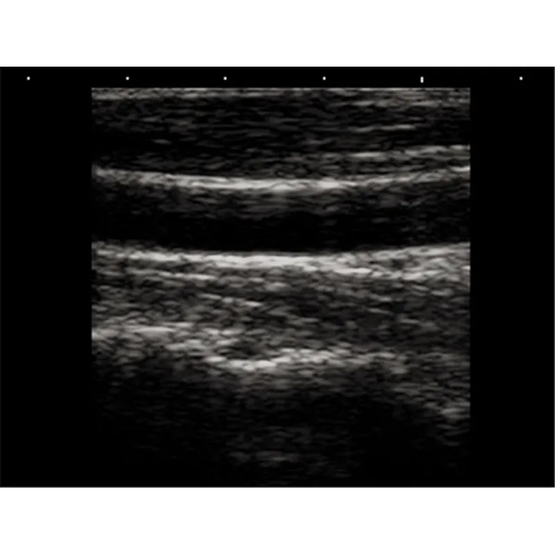 LX-BW-T5 B ULTRASOUND