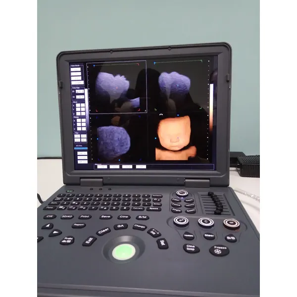 LX-CB-L1 B ULTRASOUND