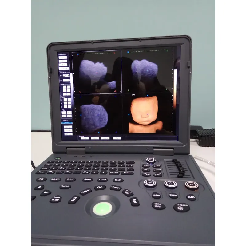 LX-CB-L1 B ULTRASOUND