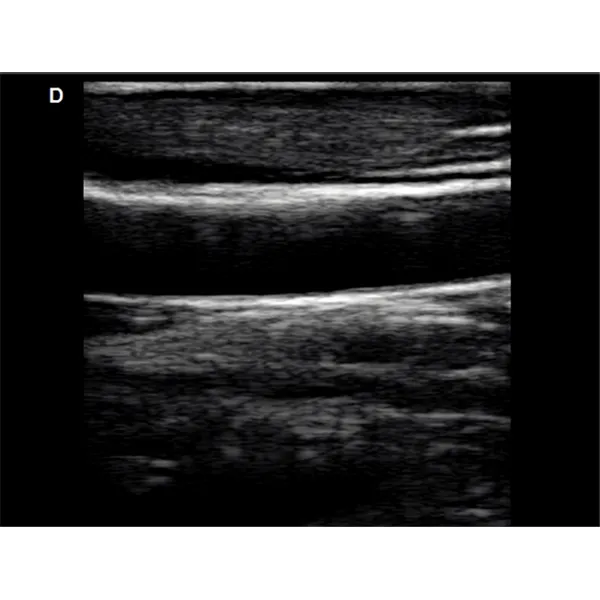 LX-CB-L1 B ULTRASOUND
