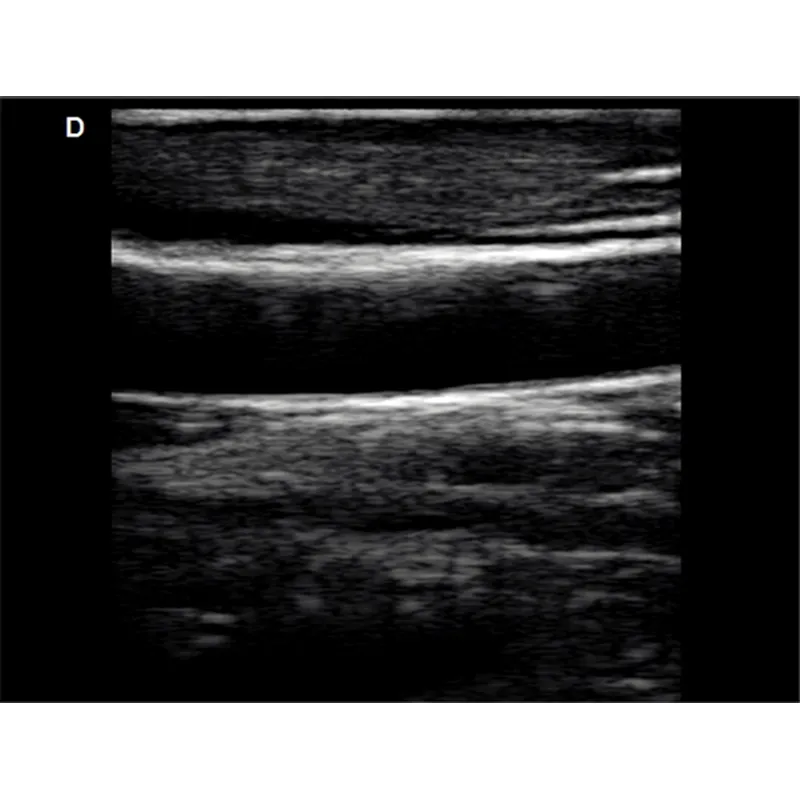 LX-CB-L1 B ULTRASOUND