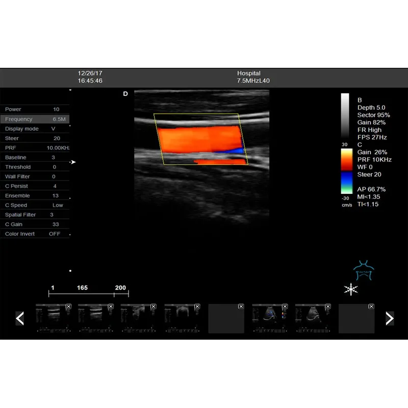 LX-CB-L1 B ULTRASOUND
