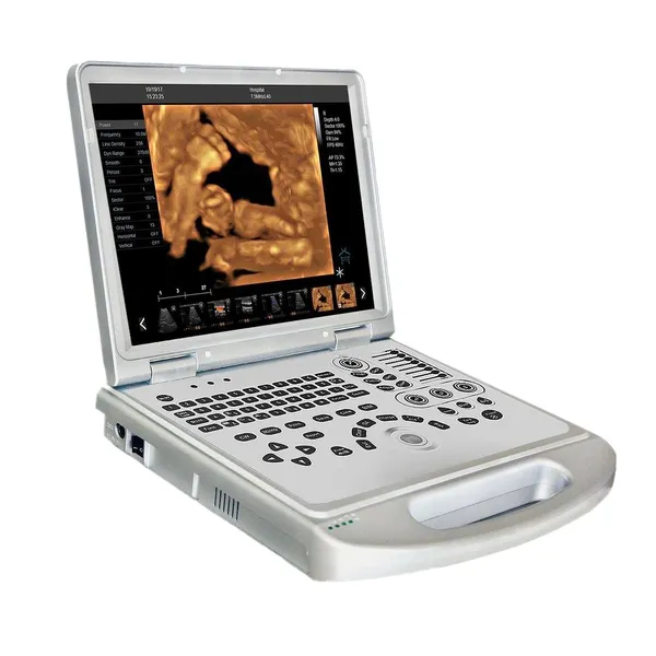 LX-CB-L2 B ULTRASOUND