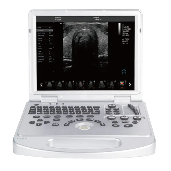 LX-CB-L2 B ULTRASOUND