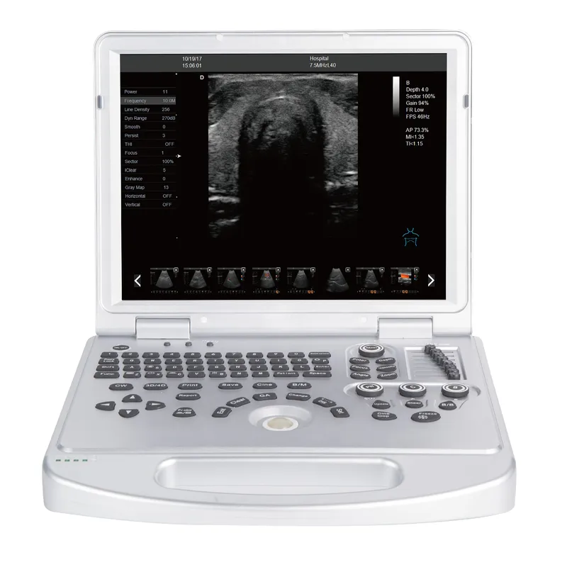 LX-CB-L2 B ULTRASOUND