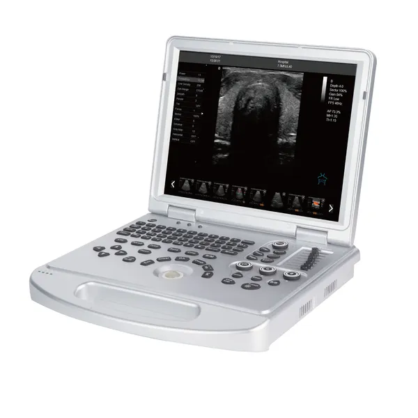 LX-CB-L2 B ULTRASOUND