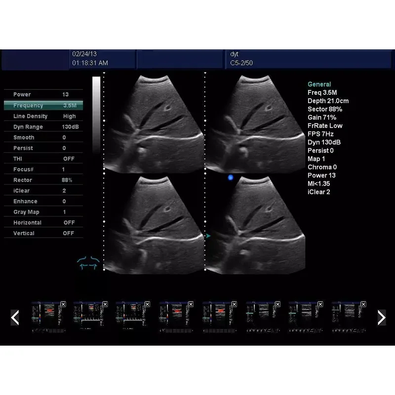 Computer Ward Round Cart