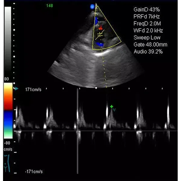 Computer Ward Round Cart