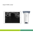 Super Width Linear Probe Type Wireless Mini Ultrasound Scanner