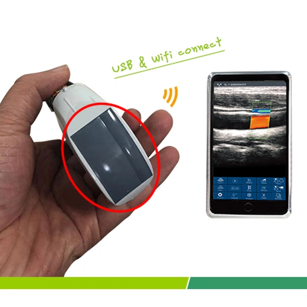 Convex/Linear/Phasedarray probe type ultrasound scanner