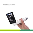 XProbe Series Built-in Screen Wireless Probe Type Ultrasound Scanner