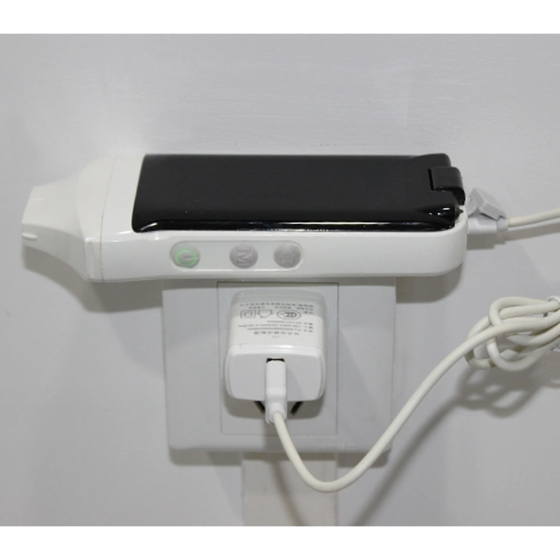 XProbe Series Built-in Screen Wireless Probe Type Ultrasound Scanner