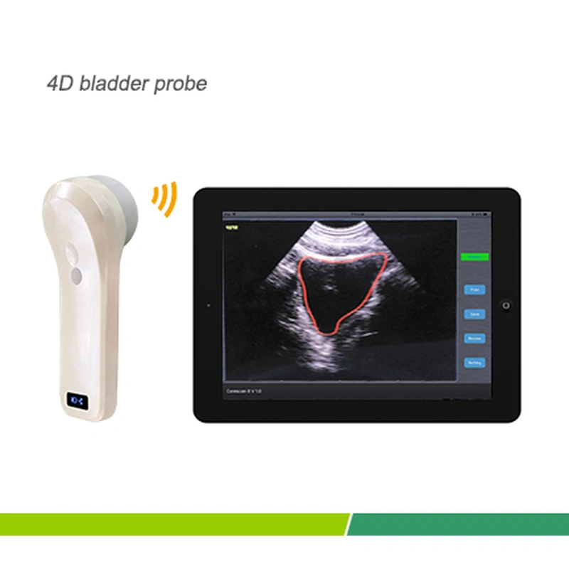 BProbe-2 4D Wireless Bladder Scanner
