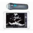 UProbe-1 Wireless Probe Ultrasound Scanner