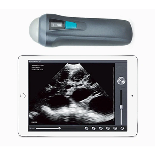 UProbe-1 Wireless Probe Ultrasound Scanner