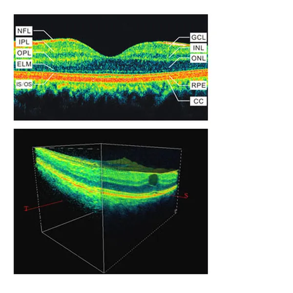 SO-2000 Posterior segment OCT