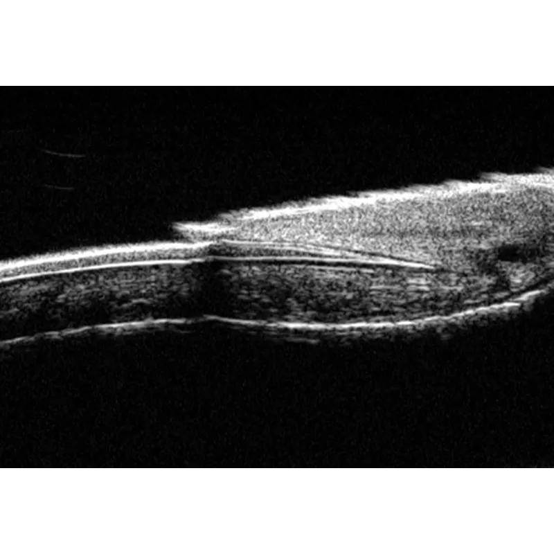UBM-100 Ultrasound Biomicroscopy Microscope