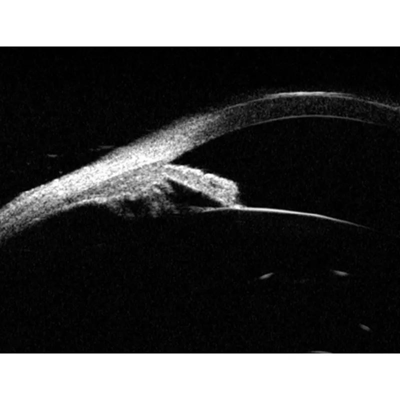 UBM-100 Ultrasound Biomicroscopy Microscope