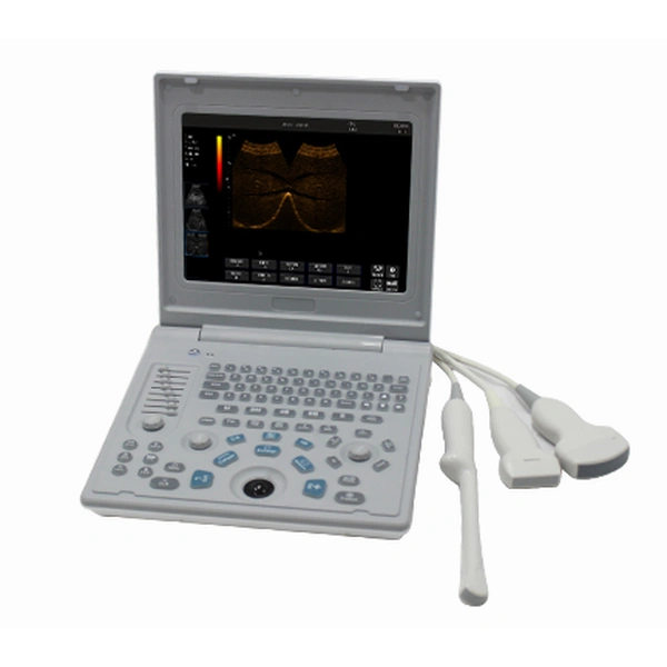 Laptop All-Digital Ultrasound Diagnostic System