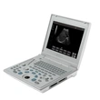 Laptop All-Digital Ultrasound Diagnostic System