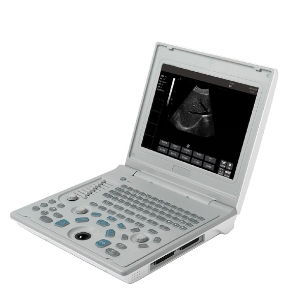 Laptop All-Digital Ultrasound Diagnostic System