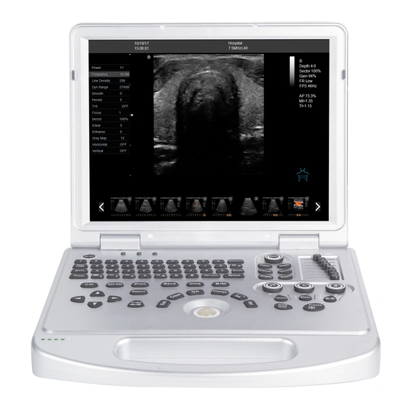 Notebook Ultrasound machine 5D Color Ultrasonic Diagnostic Apparatus