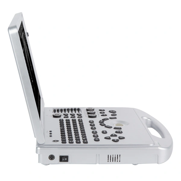 Notebook Ultrasound machine 5D Color Ultrasonic Diagnostic Apparatus