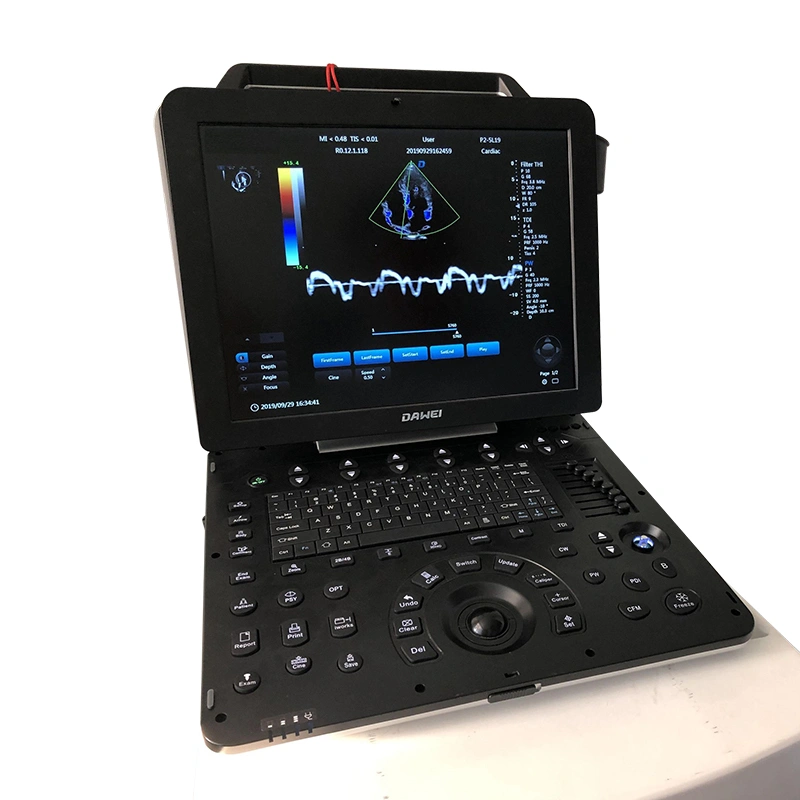 Color Ultrasonic Diagnostic Apparatus Phased array probe