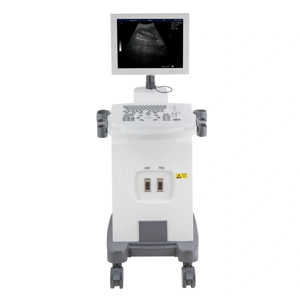 Low cost Trolley B&W ultrasound full digital machine ultrasound scan 