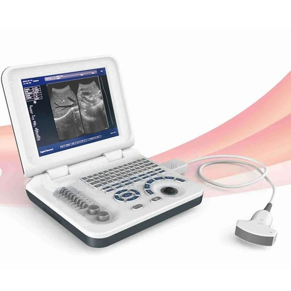 Home Products Diagnostic Equipment Ultrasound Scanner