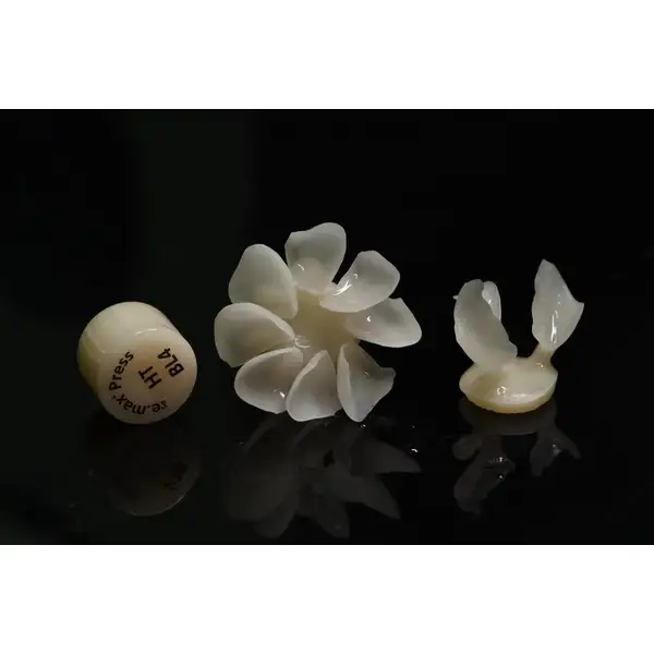 IPS EMAX VENEER MINIMAL PREP VENEERS