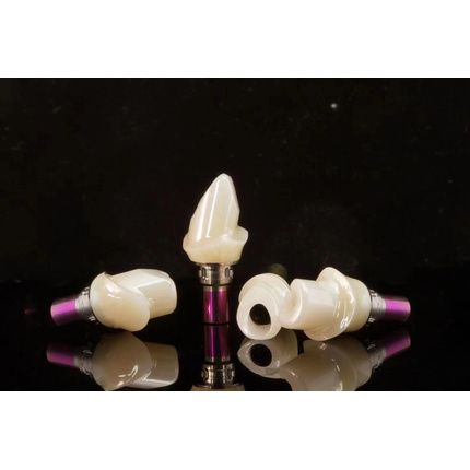 CUSTOM CAD/CAM IMPLANTS ABUTMENTS