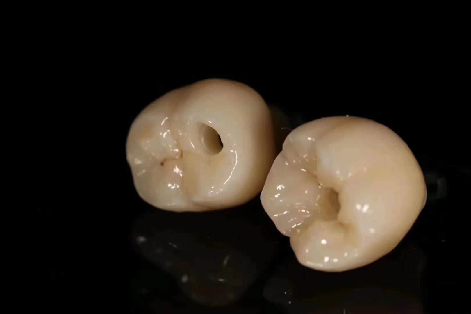 Implant SCREW RETAINED